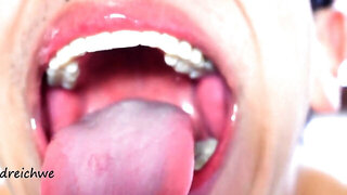 Delicious Wide Open Mouth With Lots Of Saliva